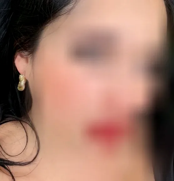 Nagore, 37 años